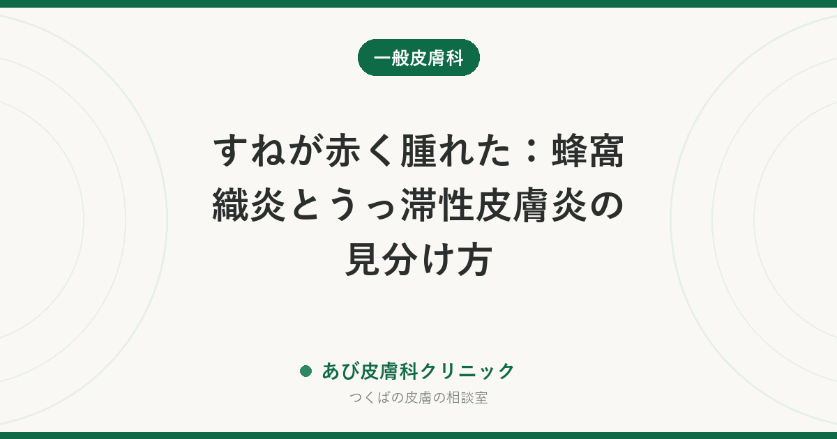 すねが赤く腫れた：蜂窩織炎とうっ滞性皮膚炎の見分け方｜片足か両足か・熱があるかで変わる受診の急ぎ度
