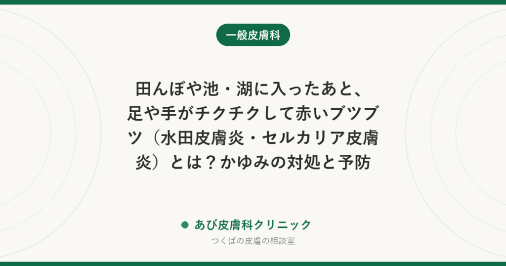 田んぼや池・湖に入ったあと、足や手がチクチクして赤いブツブツ（水田皮膚炎・セルカリア皮膚炎）とは？かゆみの対処と予防