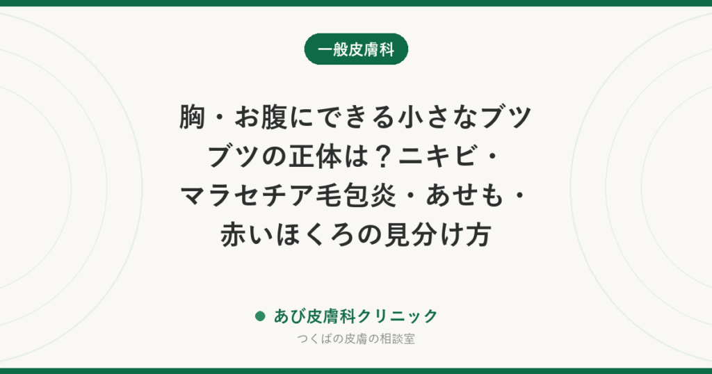 胸・お腹にできる小さなブツブツの正体は？ニキビ・マラセチア毛包炎・あせも・赤いほくろの見分け方