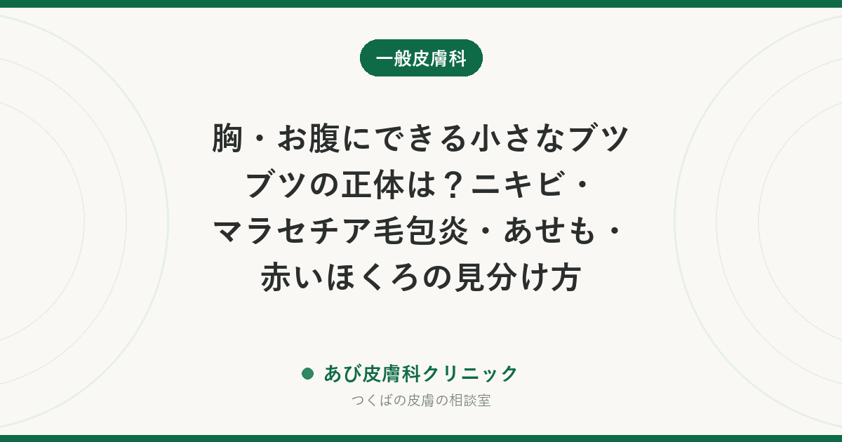 胸・お腹にできる小さなブツブツの正体は？ニキビ・マラセチア毛包炎・あせも・赤いほくろの見分け方