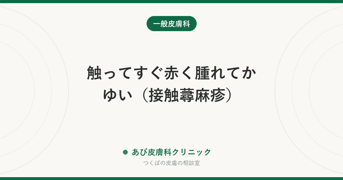 触ってすぐ赤く腫れてかゆい（接触蕁麻疹）｜ゴム手袋・食材・動物が原因のことも。かぶれとの違いと受診の目安