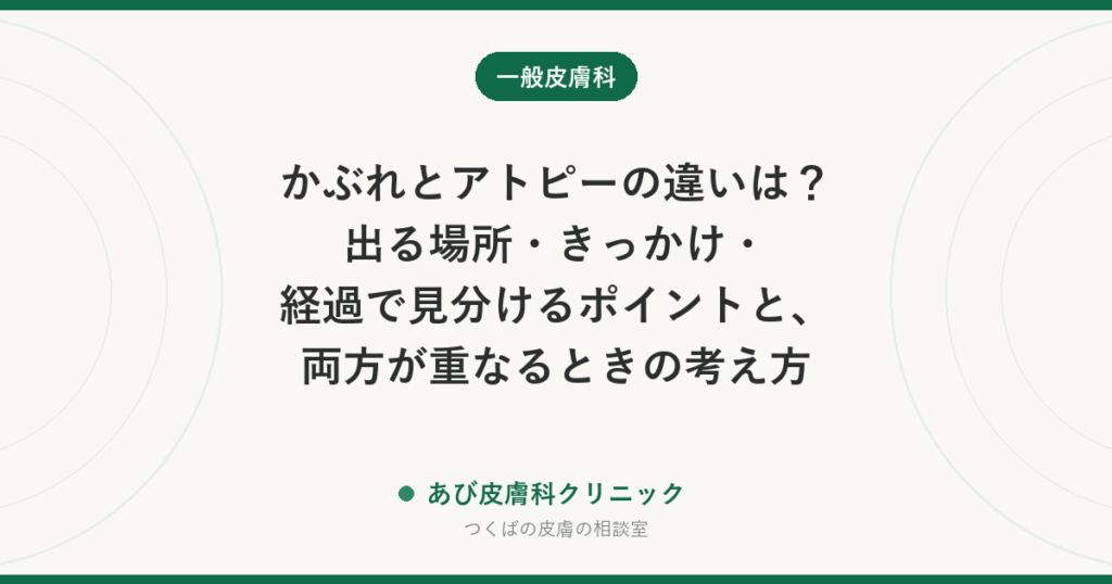 かぶれとアトピーの違いは？出る場所・きっかけ・経過で見分けるポイントと、両方が重なるときの考え方