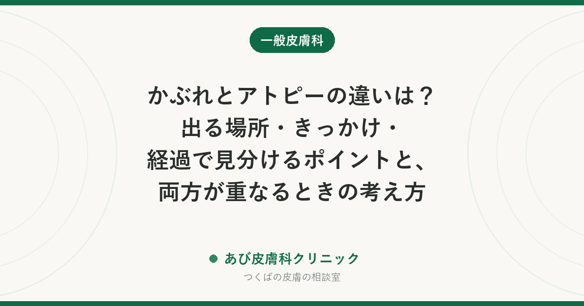 かぶれとアトピーの違いは？出る場所・きっかけ・経過で見分けるポイントと、両方が重なるときの考え方