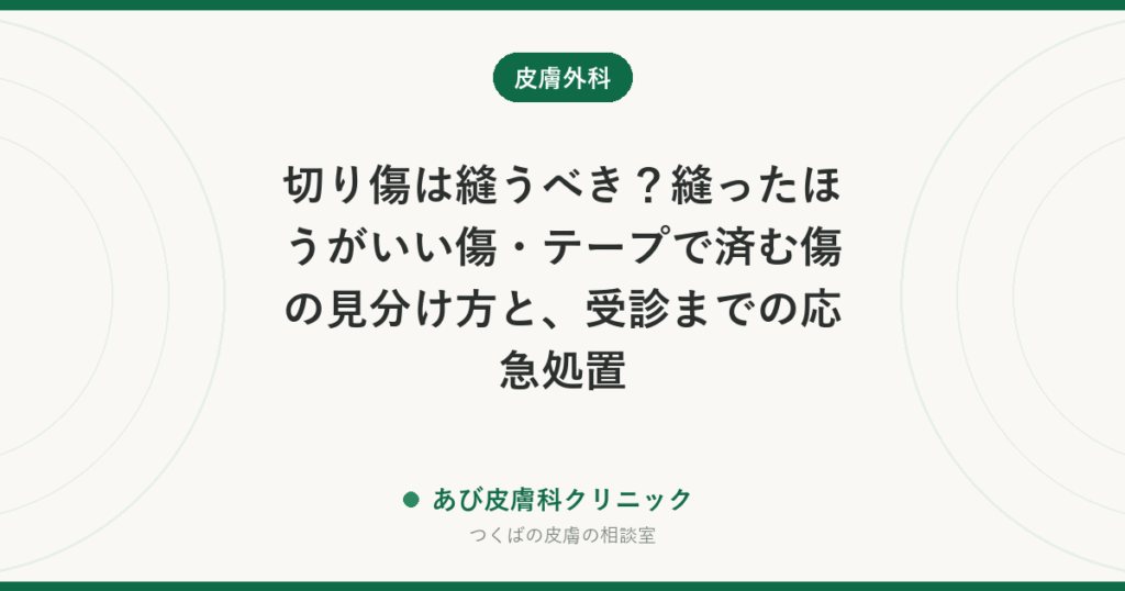 切り傷は縫うべき？縫ったほうがいい傷・テープで済む傷の見分け方と、受診までの応急処置