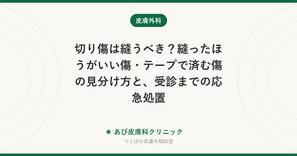 切り傷は縫うべき？縫ったほうがいい傷・テープで済む傷の見分け方と、受診までの応急処置