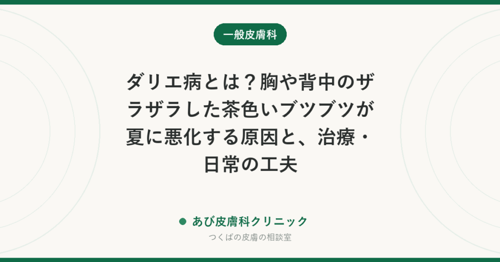 ダリエ病とは？胸や背中のザラザラした茶色いブツブツが夏に悪化する原因と、治療・日常の工夫