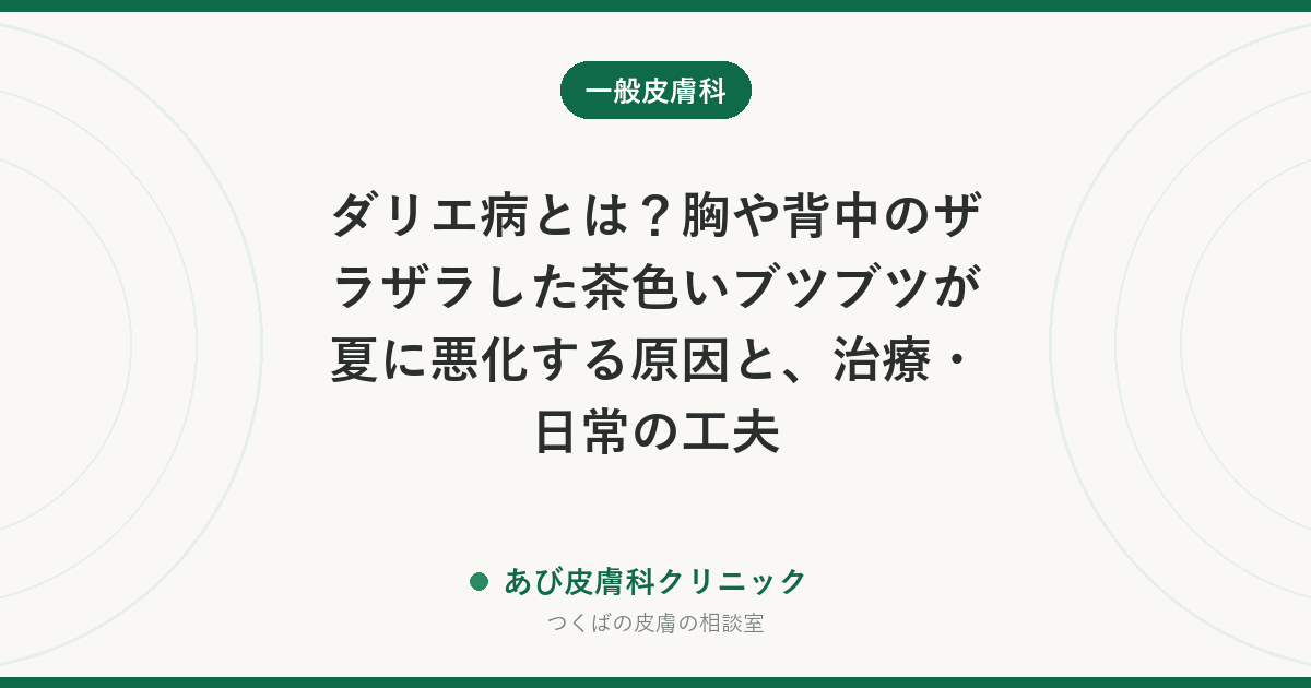 ダリエ病とは？胸や背中のザラザラした茶色いブツブツが夏に悪化する原因と、治療・日常の工夫