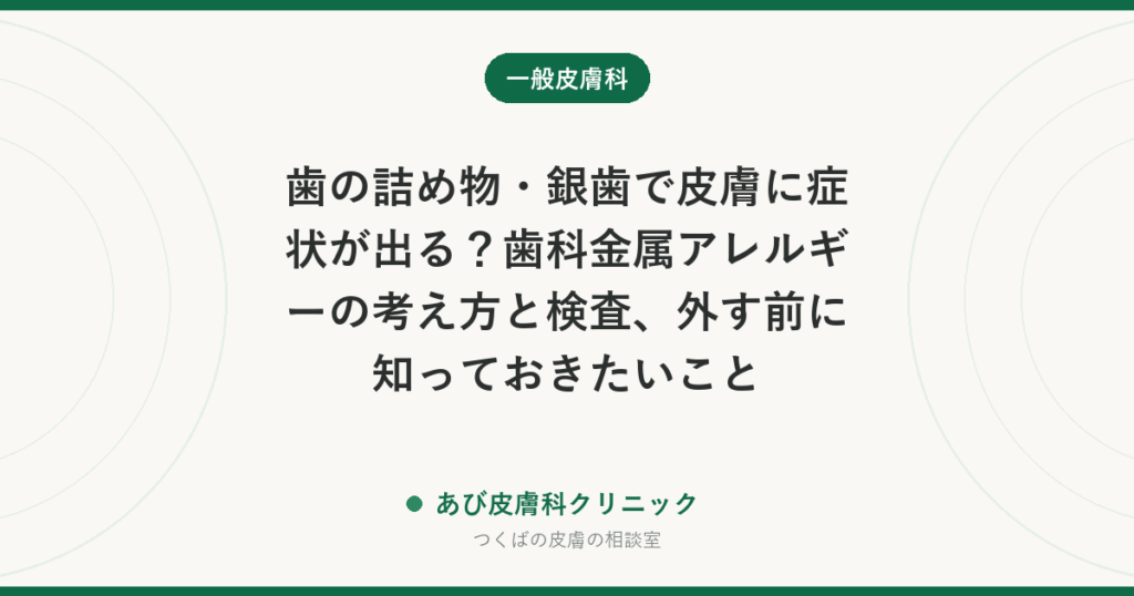 歯の詰め物・銀歯で皮膚に症状が出る？歯科金属アレルギーの考え方と検査、外す前に知っておきたいこと