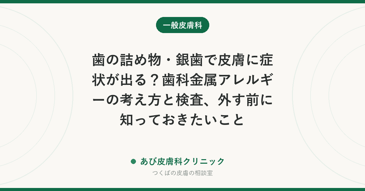 歯の詰め物・銀歯で皮膚に症状が出る？歯科金属アレルギーの考え方と検査、外す前に知っておきたいこと