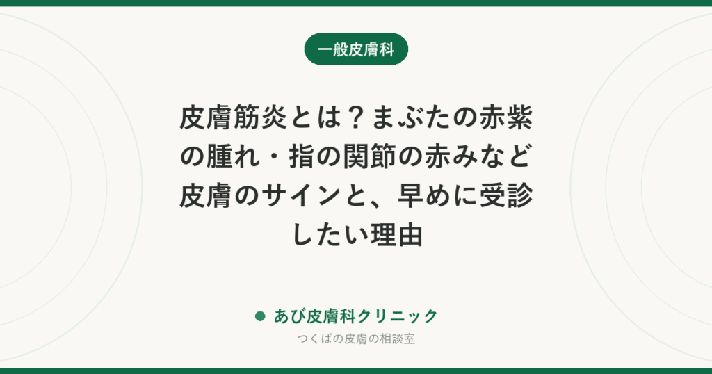 皮膚筋炎とは？まぶたの赤紫の腫れ・指の関節の赤みなど皮膚のサインと、早めに受診したい理由