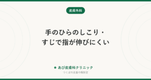 手のひらのしこり・すじで指が伸びにくい｜デュピュイトラン拘縮とは？ガングリオンなどとの違いと受診の目安