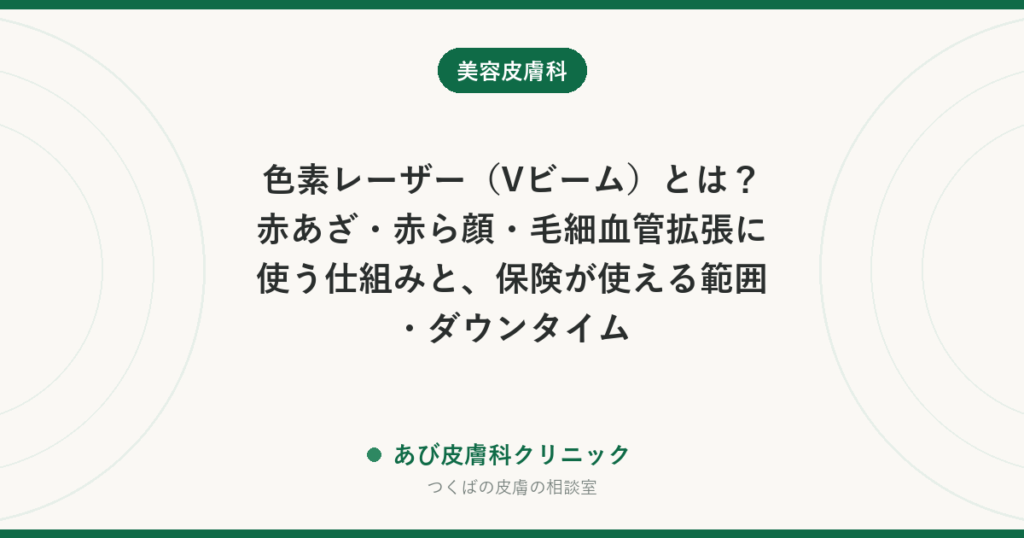 色素レーザー（Vビーム）とは？赤あざ・赤ら顔・毛細血管拡張に使う仕組みと、保険が使える範囲・ダウンタイム