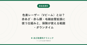 色素レーザー（Vビーム）とは？赤あざ・赤ら顔・毛細血管拡張に使う仕組みと、保険が使える範囲・ダウンタイム