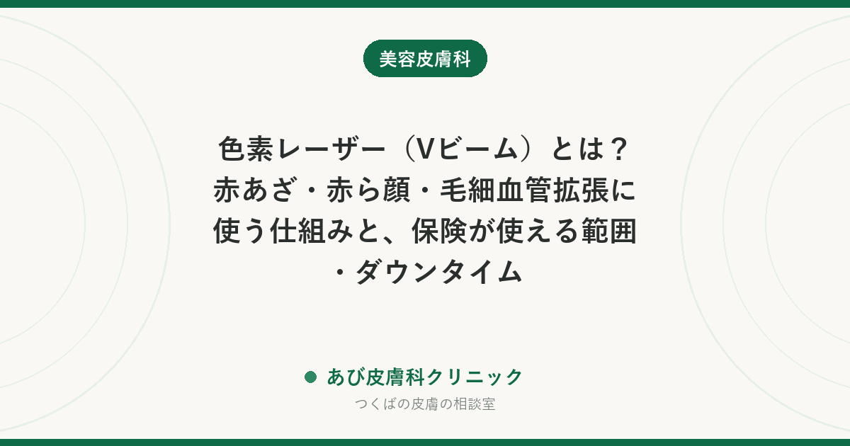 色素レーザー（Vビーム）とは？赤あざ・赤ら顔・毛細血管拡張に使う仕組みと、保険が使える範囲・ダウンタイム