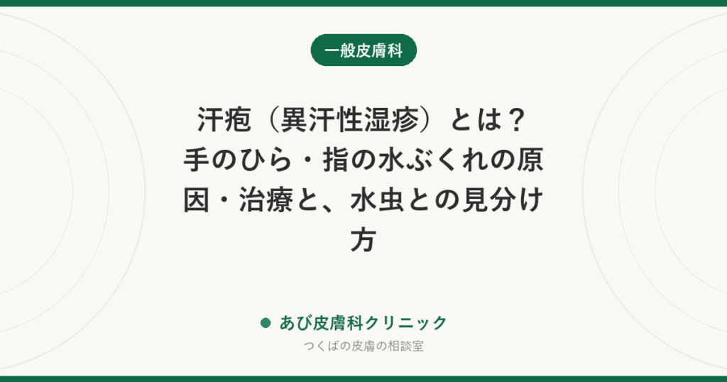 汗疱（異汗性湿疹）とは？手のひら・指の水ぶくれの原因・治療と、水虫との見分け方