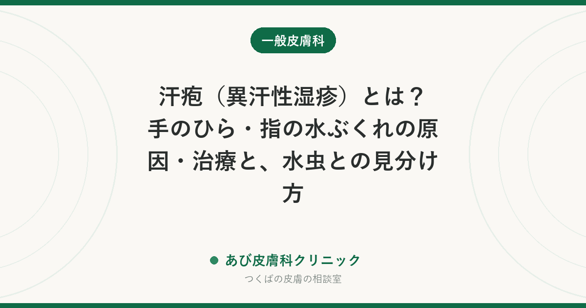汗疱（異汗性湿疹）とは？手のひら・指の水ぶくれの原因・治療と、水虫との見分け方