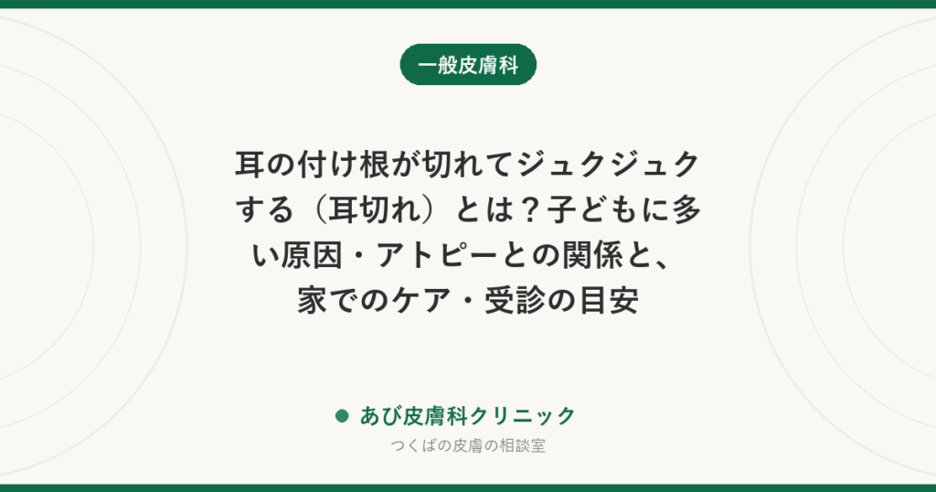 耳の付け根が切れてジュクジュクする（耳切れ）とは？子どもに多い原因・アトピーとの関係と、家でのケア・受診の目安