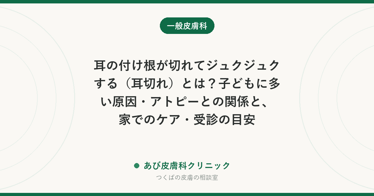 耳の付け根が切れてジュクジュクする（耳切れ）とは？子どもに多い原因・アトピーとの関係と、家でのケア・受診の目安