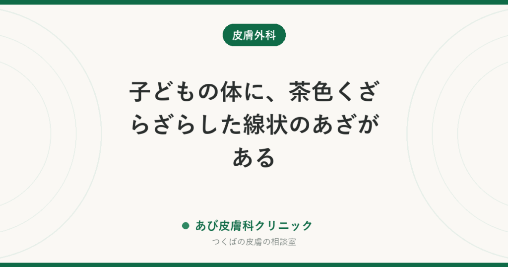 子どもの体に、茶色くざらざらした線状のあざがある｜表皮母斑とは？成長での変化と、取るなら知っておきたい治療の考え方
