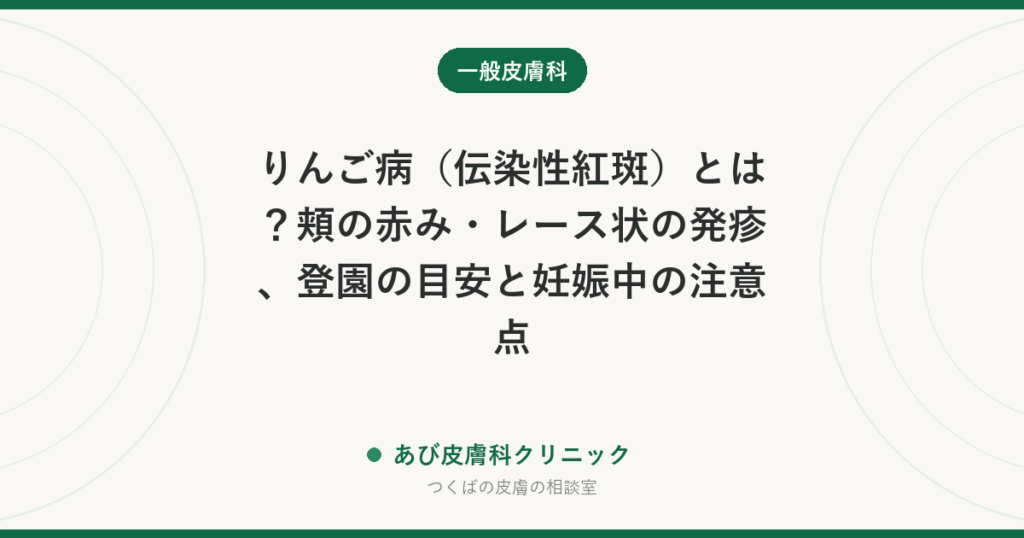 りんご病（伝染性紅斑）とは？頬の赤み・レース状の発疹、登園の目安と妊娠中の注意点