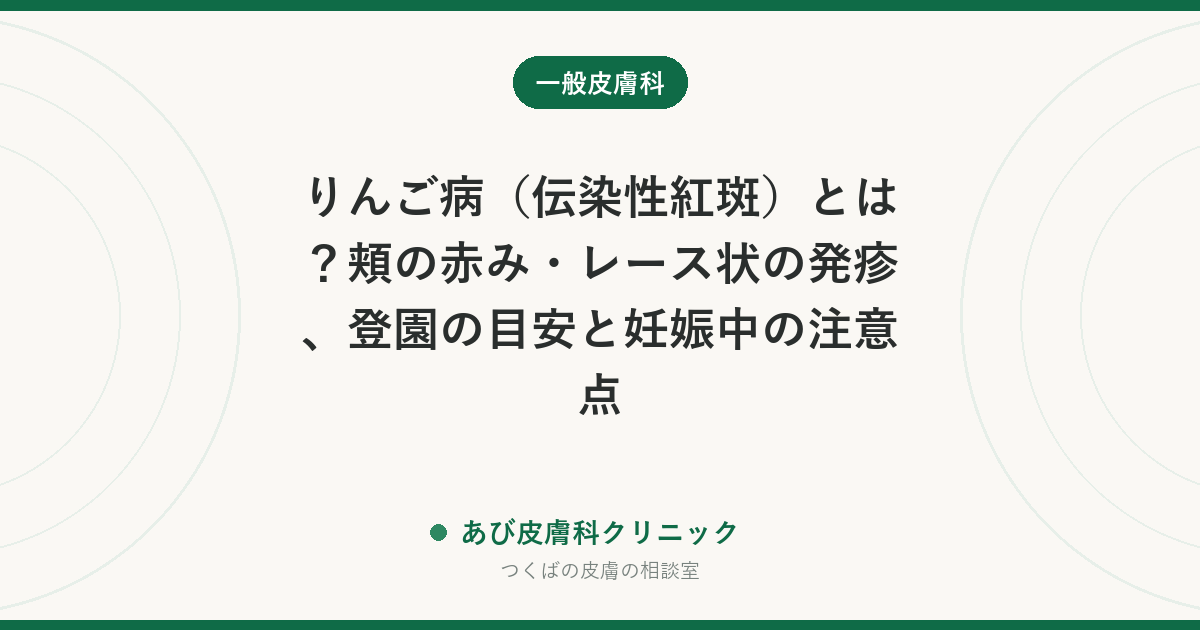 りんご病（伝染性紅斑）とは？頬の赤み・レース状の発疹、登園の目安と妊娠中の注意点