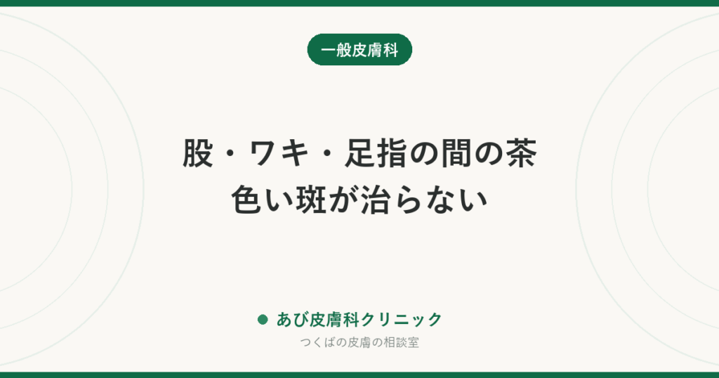 股・ワキ・足指の間の茶色い斑が治らない｜紅色陰癬（こうしょくいんせん）とは？水虫・いんきんたむしとの違いと治し方
