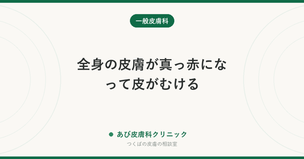 全身の皮膚が真っ赤になって皮がむける｜紅皮症の原因と、急いで受診すべきサイン