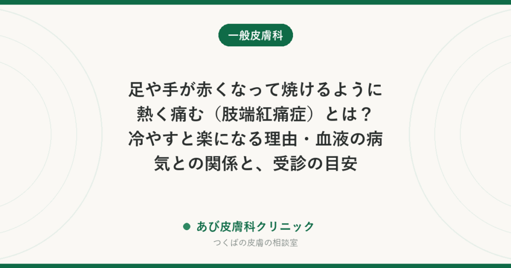 足や手が赤くなって焼けるように熱く痛む（肢端紅痛症）とは？冷やすと楽になる理由・血液の病気との関係と、受診の目安