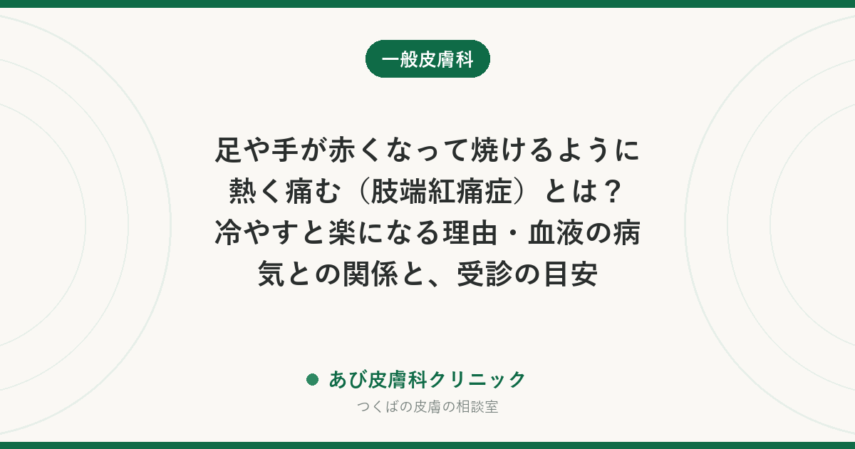 足や手が赤くなって焼けるように熱く痛む（肢端紅痛症）とは？冷やすと楽になる理由・血液の病気との関係と、受診の目安