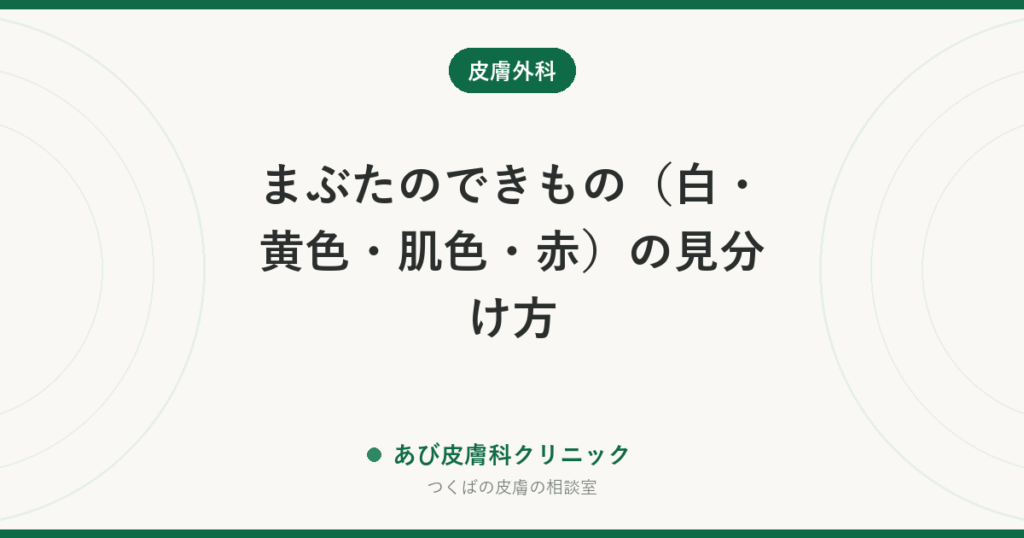 まぶたのできもの（白・黄色・肌色・赤）の見分け方｜稗粒腫・汗管腫・黄色腫・霰粒腫など、皮膚科と眼科どちらに行くか
