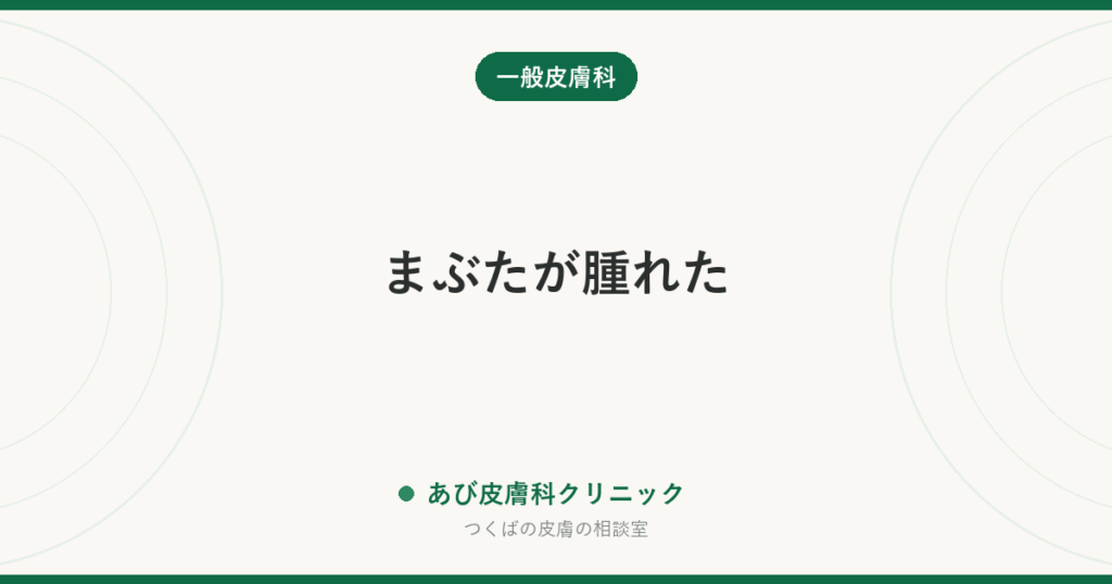 まぶたが腫れた｜ものもらい・かぶれ・むくみの見分け方と、眼科と皮膚科どちらに行くかの目安