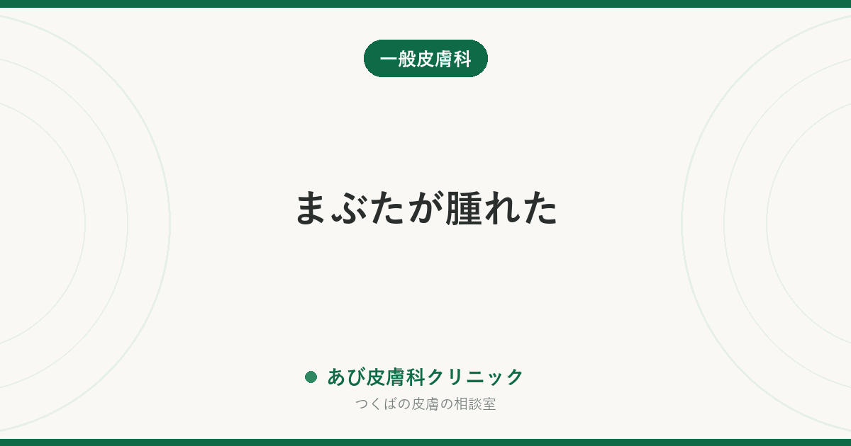 まぶたが腫れた｜ものもらい・かぶれ・むくみの見分け方と、眼科と皮膚科どちらに行くかの目安
