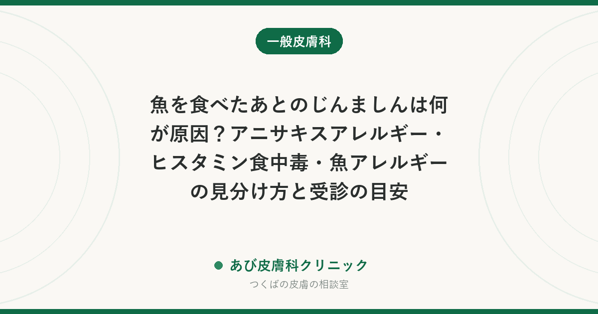 魚を食べたあとのじんましんは何が原因？アニサキスアレルギー・ヒスタミン食中毒・魚アレルギーの見分け方と受診の目安