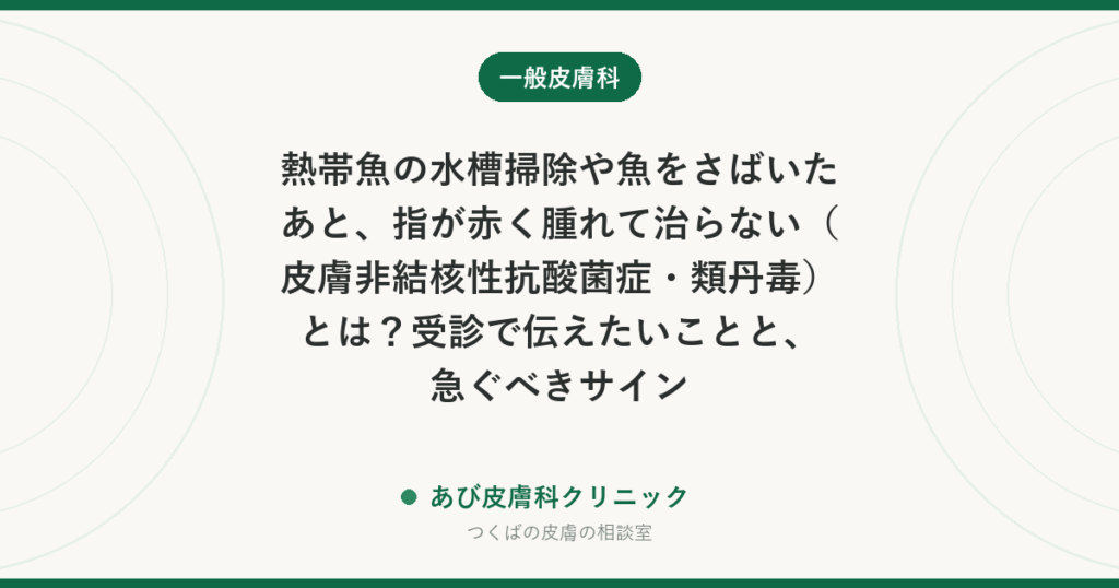熱帯魚の水槽掃除や魚をさばいたあと、指が赤く腫れて治らない（皮膚非結核性抗酸菌症・類丹毒）とは？受診で伝えたいことと、急ぐべきサイン