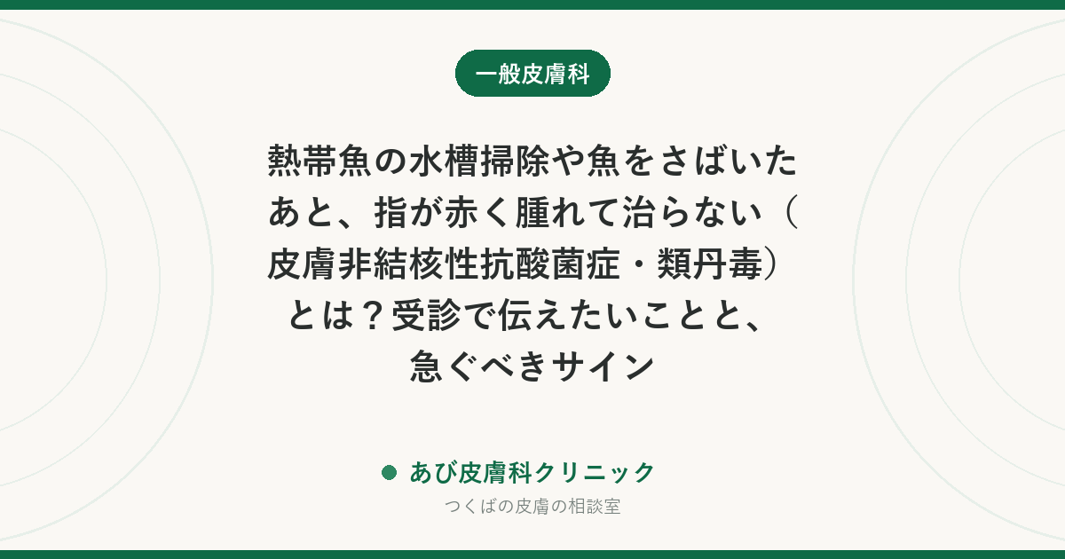 熱帯魚の水槽掃除や魚をさばいたあと、指が赤く腫れて治らない（皮膚非結核性抗酸菌症・類丹毒）とは？受診で伝えたいことと、急ぐべきサイン