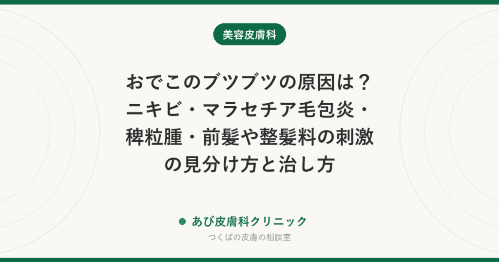 おでこのブツブツの原因は？ニキビ・マラセチア毛包炎・稗粒腫・前髪や整髪料の刺激の見分け方と治し方
