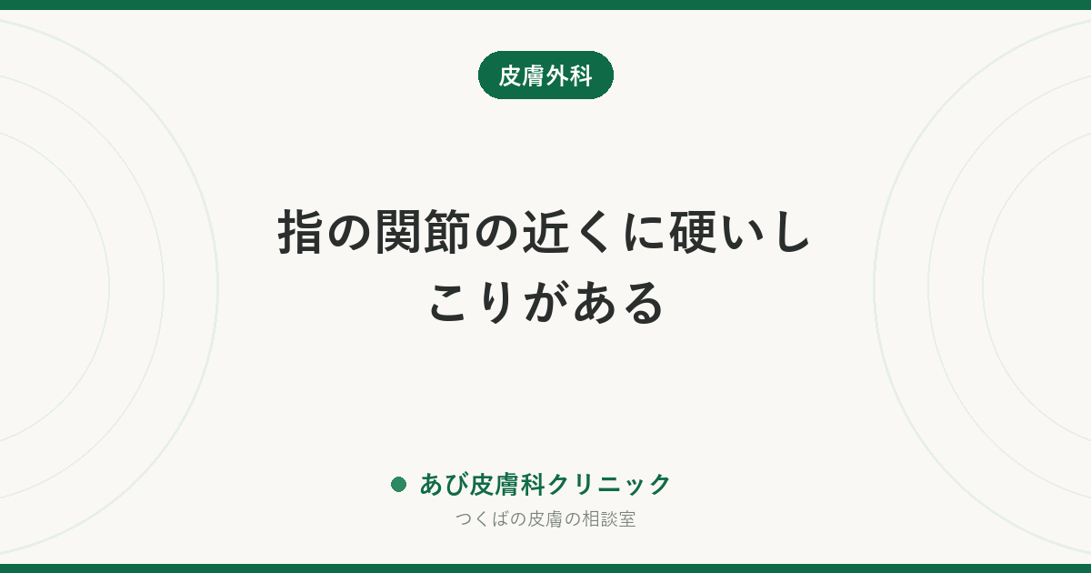 指の関節の近くに硬いしこりがある｜腱鞘巨細胞腫とは？ガングリオンとの違い、手術と再発の考え方
