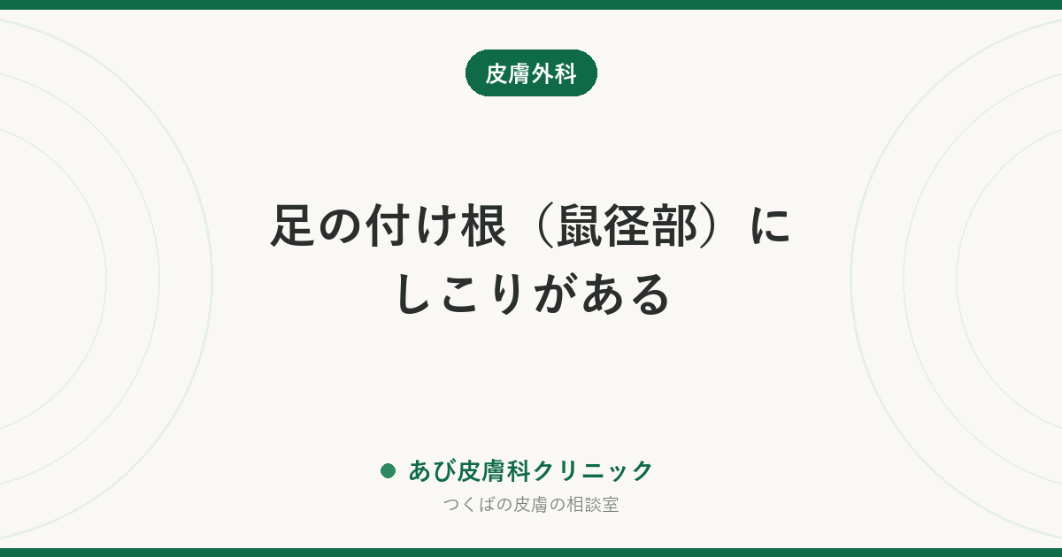 足の付け根（鼠径部）にしこりがある｜リンパ節・粉瘤・ヘルニアの見分け方と受診の目安