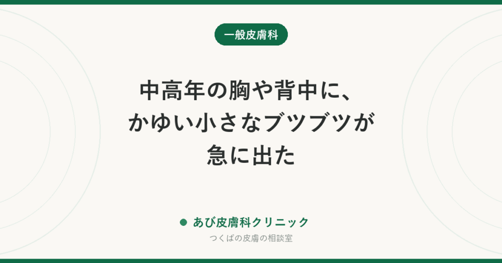 中高年の胸や背中に、かゆい小さなブツブツが急に出た｜グローバー病（一過性棘融解性皮膚症）とは？汗・熱との関係と治し方