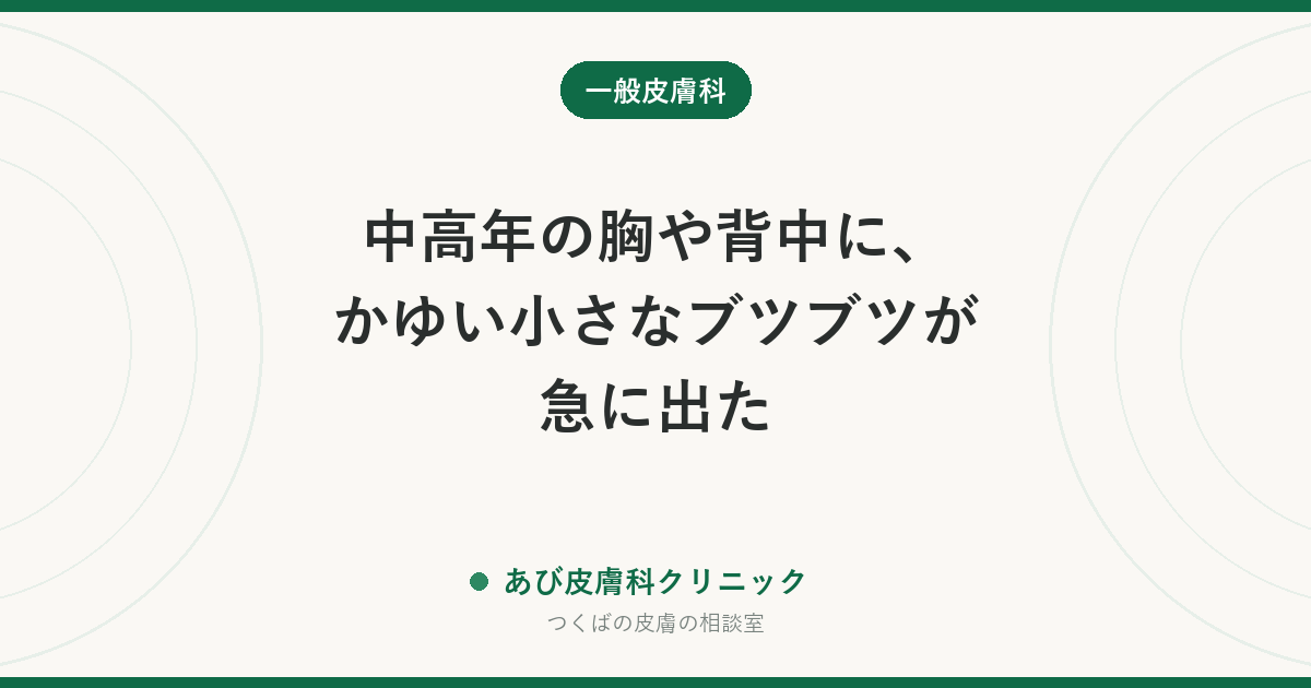 中高年の胸や背中に、かゆい小さなブツブツが急に出た｜グローバー病（一過性棘融解性皮膚症）とは？汗・熱との関係と治し方
