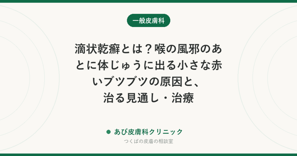 滴状乾癬とは？喉の風邪のあとに体じゅうに出る小さな赤いブツブツの原因と、治る見通し・治療