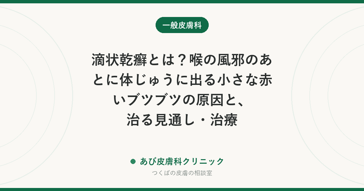 滴状乾癬とは？喉の風邪のあとに体じゅうに出る小さな赤いブツブツの原因と、治る見通し・治療