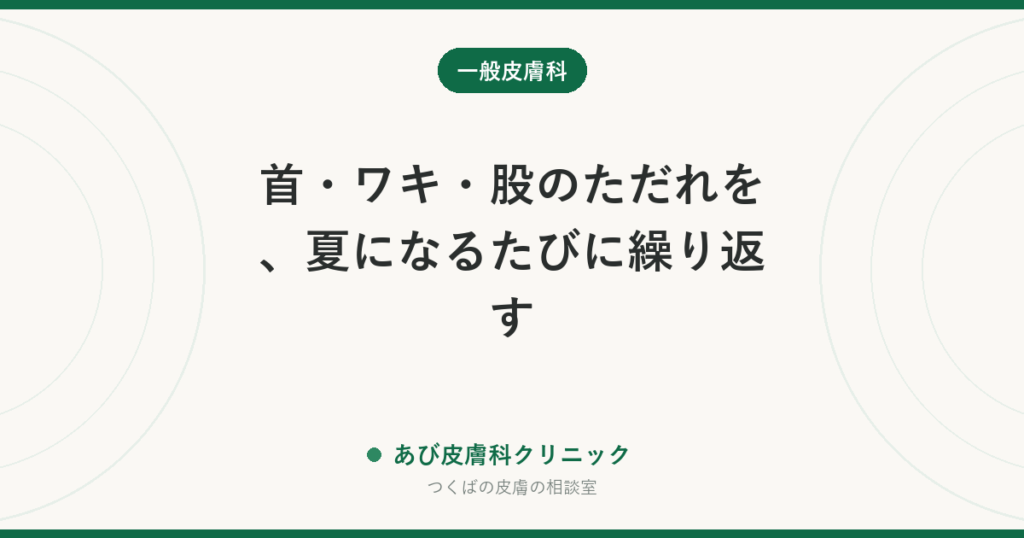 首・ワキ・股のただれを、夏になるたびに繰り返す｜ヘイリー・ヘイリー病とは？湿疹・カンジダとの違いと悪化を防ぐ方法