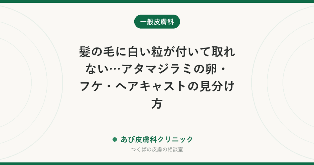 髪の毛に白い粒が付いて取れない…アタマジラミの卵・フケ・ヘアキャストの見分け方｜子どもの頭で見つけたときの確かめ方