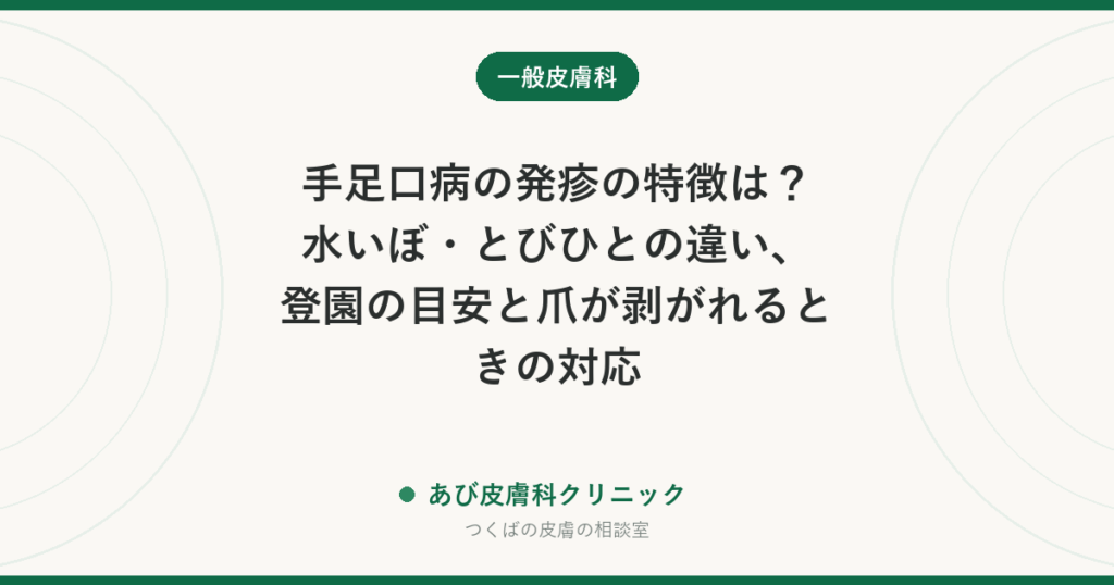 手足口病の発疹の特徴は？水いぼ・とびひとの違い、登園の目安と爪が剥がれるときの対応