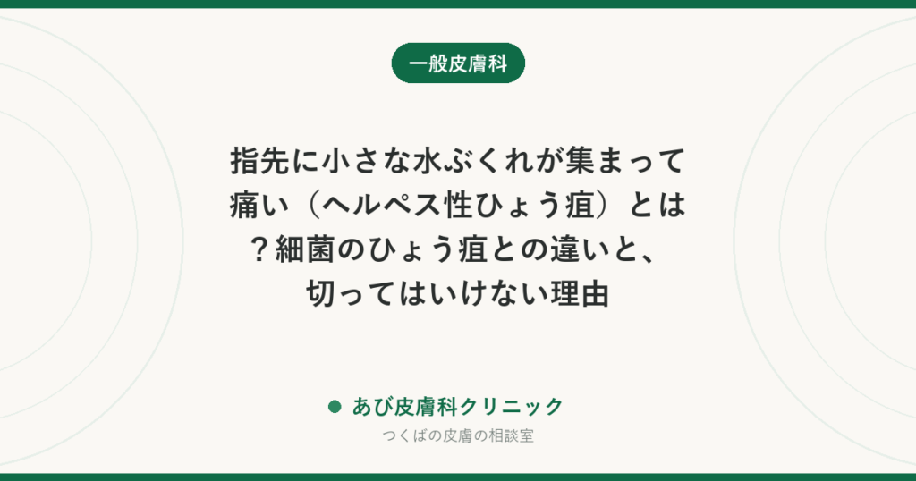 指先に小さな水ぶくれが集まって痛い（ヘルペス性ひょう疽）とは？細菌のひょう疽との違いと、切ってはいけない理由