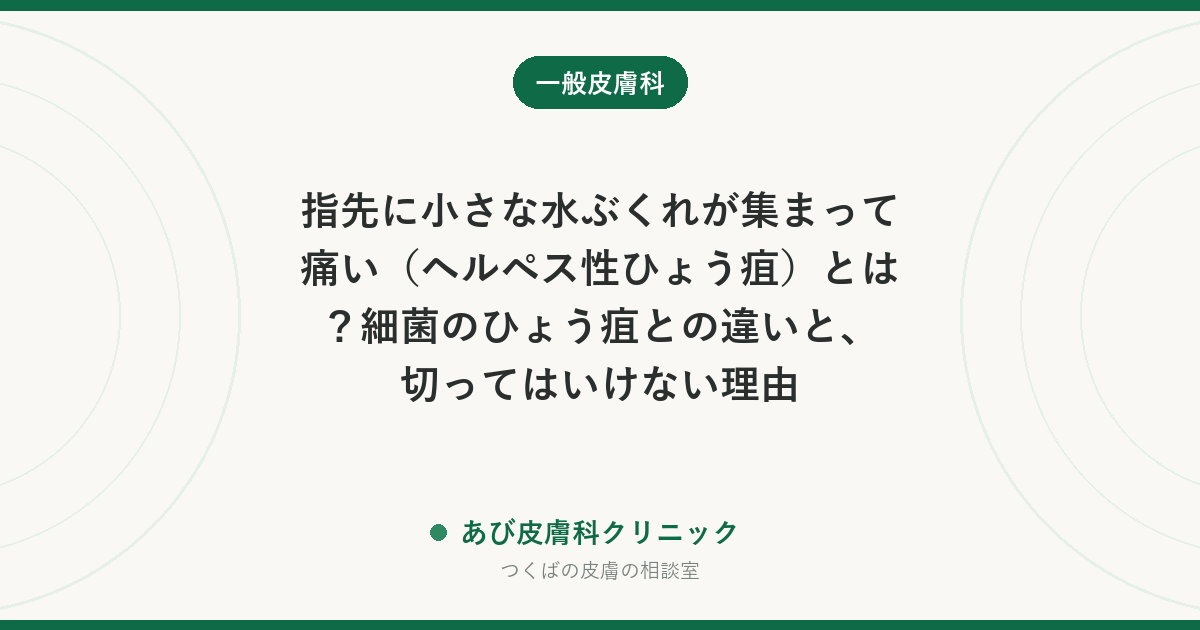 指先に小さな水ぶくれが集まって痛い（ヘルペス性ひょう疽）とは？細菌のひょう疽との違いと、切ってはいけない理由