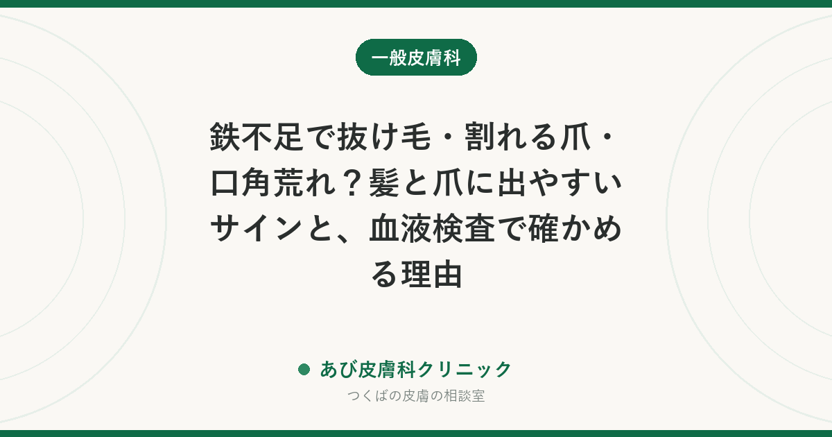 鉄不足で抜け毛・割れる爪・口角荒れ?髪と爪に出やすいサインと、血液検査で確かめる理由