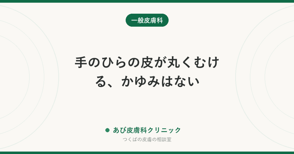 手のひらの皮が丸くむける、かゆみはない｜角質剥離症とは？汗疱・手の水虫との見分けとケア