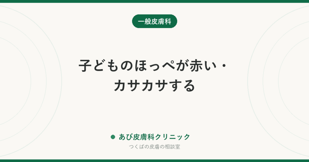 子どものほっぺが赤い・カサカサする｜乾燥・よだれ・アトピー・とびひの見分け方と、冬のスキンケア